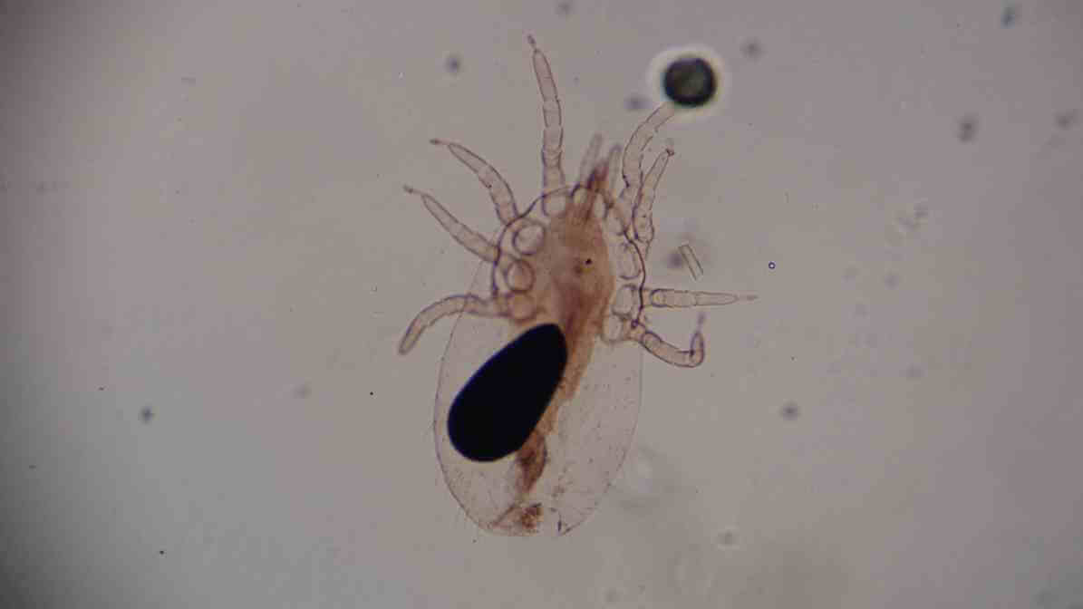 Human Fleas in Malaysia - Innovative Pest Management MY | Innovative Pest Sdn Bhd Human Fleas in Malaysia