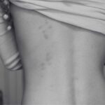 Learn More About Bed Bug Bite - Blog - Innovative Pest Management MY | Innovative Pest Sdn Bhd Learn More About Bed Bug Bite - Blog