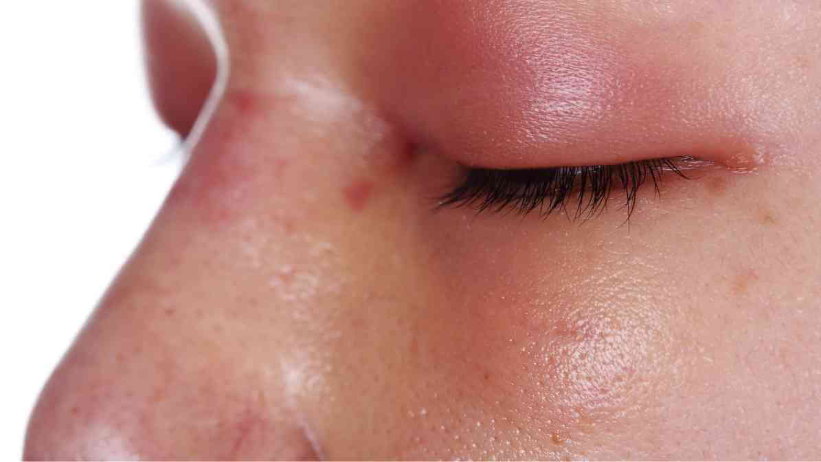 Charlie Ants Bite Swell