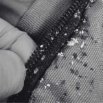 Contoh Kesan Gigitan Pepijat Di Rumah