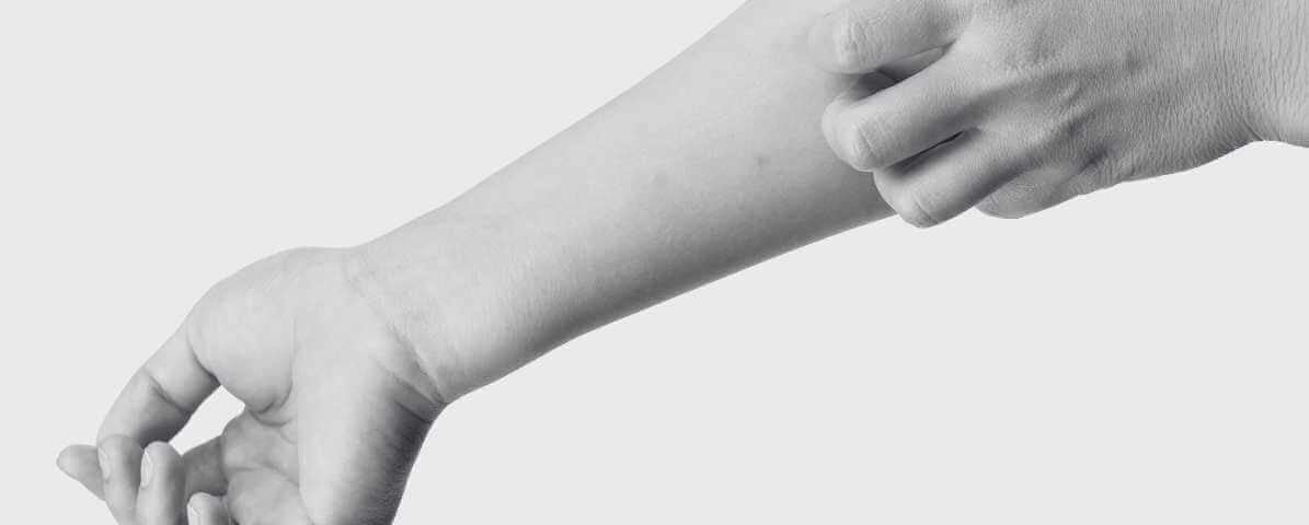 Bed Bug Bites vs Mosquito Bites