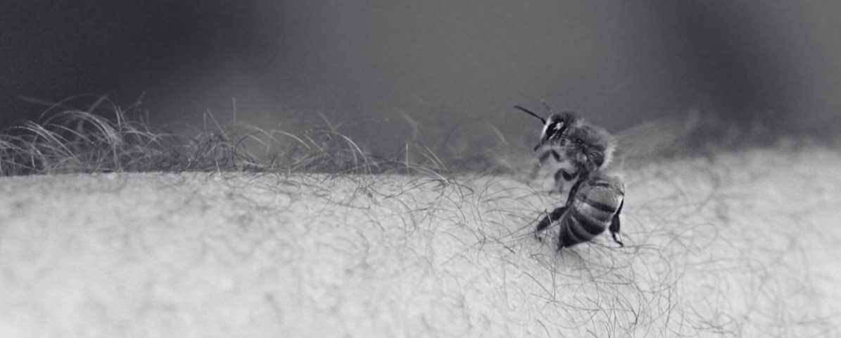 What You Need to Know About Bee Sting Treatment? | Innovative Pest Sdn Bhd What You Need to Know About Bee Sting Treatment?