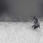 What You Need to Know About Bee Sting Treatment?