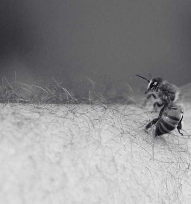 What You Need to Know About Bee Sting Treatment?