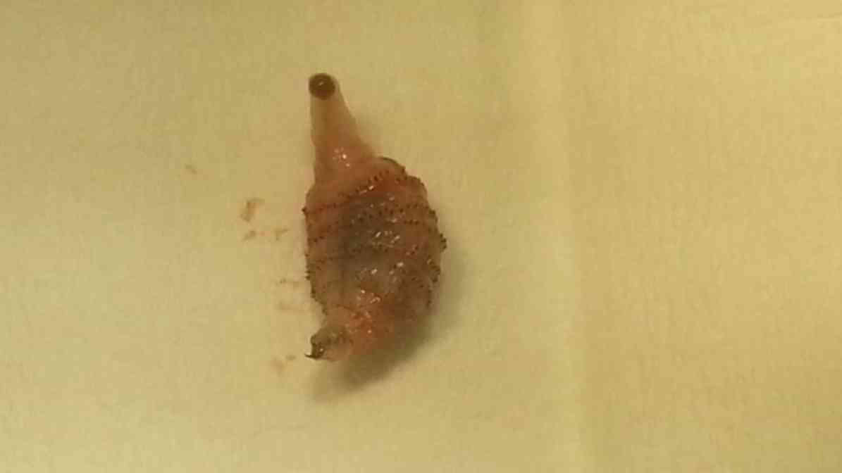 Step 4 - Botfly Removal