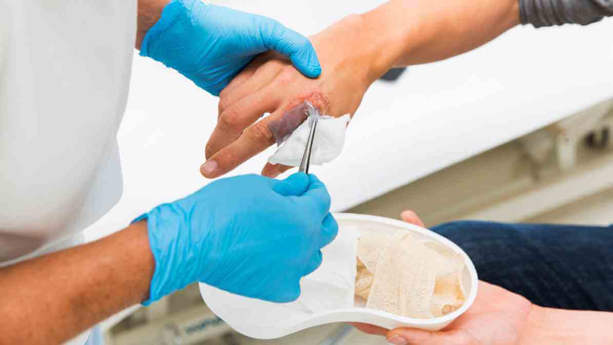 Step 6 - Botfly Removal, Monitor for Swelling
