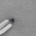 Tick Borne Diseases You Must Know