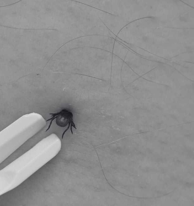 Tick Borne Diseases You Must Know