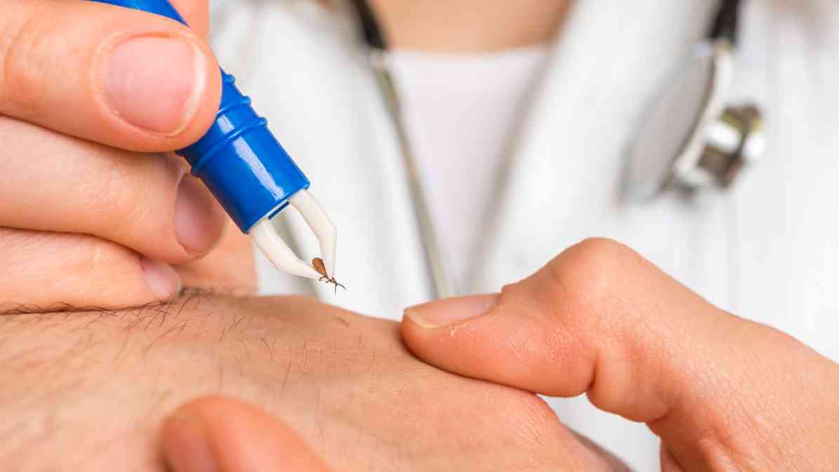 Tick Borne Diseases You Must Know - Professional Help